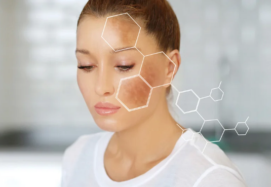 Treat the underlying cause of hyperpigmentation